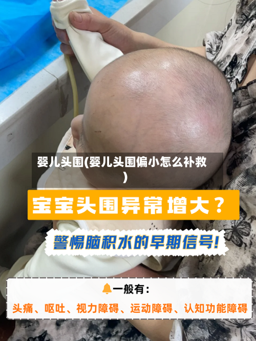 婴儿头围(婴儿头围偏小怎么补救)-第2张图片