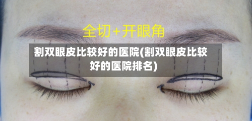 割双眼皮比较好的医院(割双眼皮比较好的医院排名)